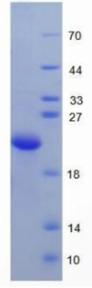 SDS PAGE (HFE2-2082H).jpg